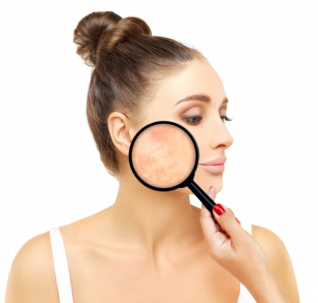 Woman with magnifting glass on face showing acne