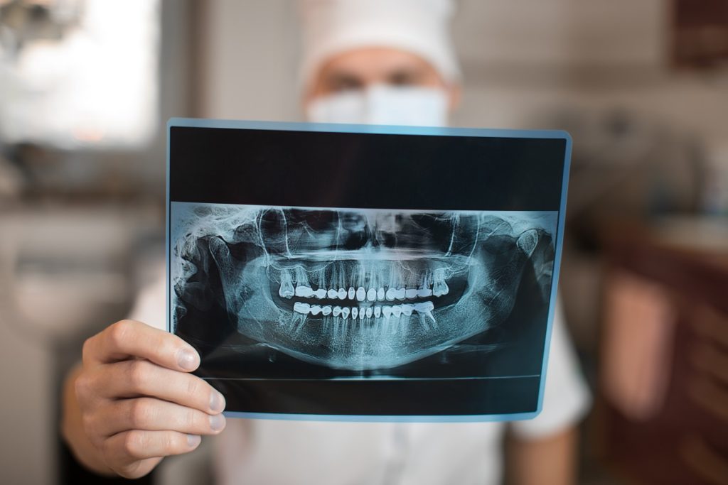 dentist looking at an xray of teeth
