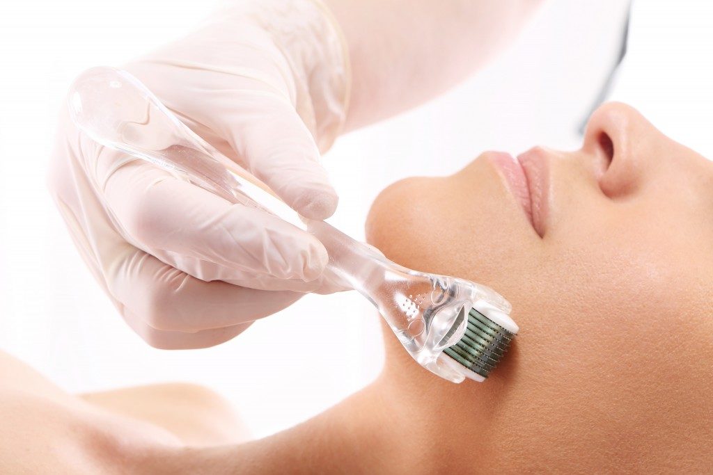 woman having microneedling done on her face