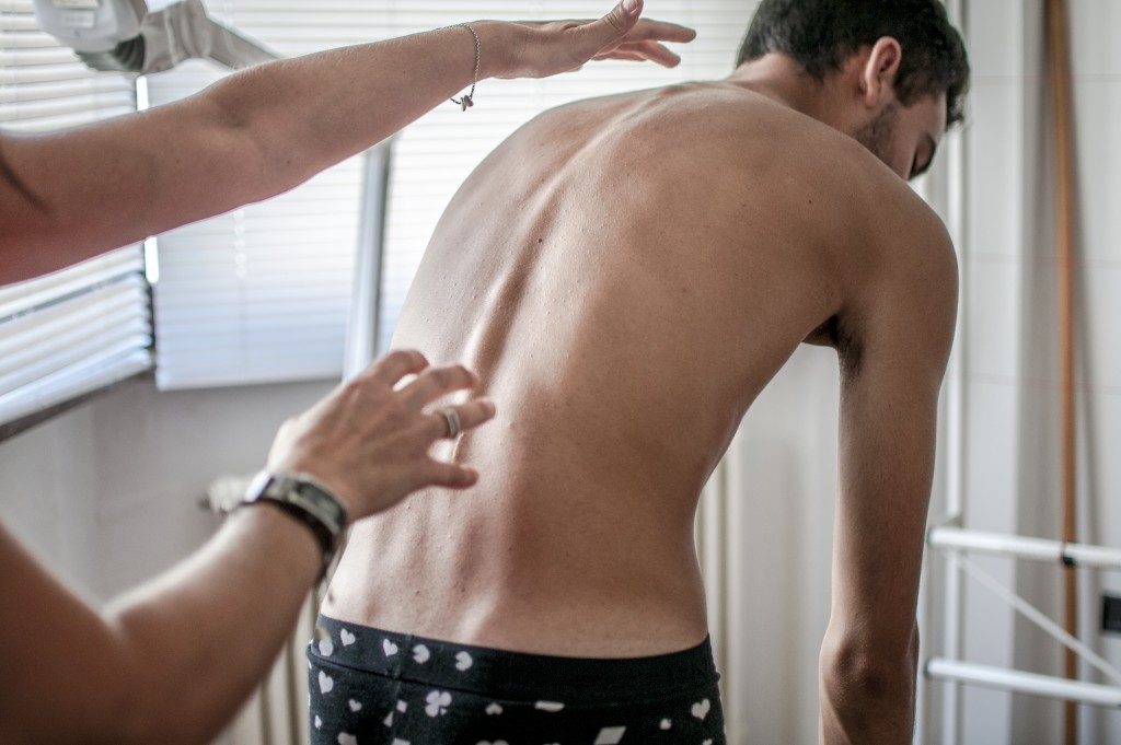 Doctor performs medical examination on patient diagnosed with Scoliosis